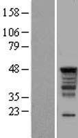 SERBP1 Human Over-expression Lysates NM_001018068