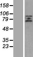 ZBTB20 Human Over-expression Lysates NM_001164345