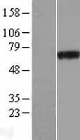 PHF19 Human Over-expression Lysates NM_015651