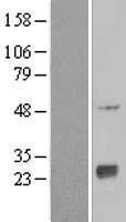 ls026151 nat9 human over expression lysates nm 015654 wb testing 1