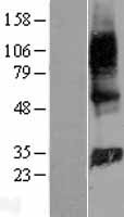 GIMAP2 Human Over-expression Lysates NM_015660