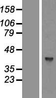 GTPBP5 (MTG2) Human Over-expression Lysates NM_015666