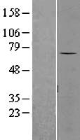 SENP3 Human Over-expression Lysates NM_015670