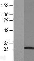 ARL5A Human Over-expression Lysates NM_012097