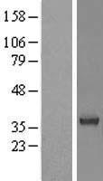 BRDG 1 (STAP1) Human Over-expression Lysates NM_012108