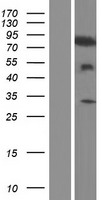 TIAM2 Human Over-expression Lysates NM_001010927