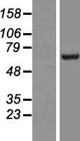 FBXL5 Human Over-expression Lysates NM_012161