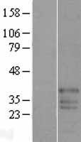 FAM50B Human Over-expression Lysates NM_012135
