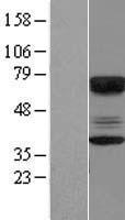 CABYR Human Over-expression Lysates NM_012189
