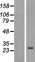 ls026260 fbxo25 human over expression lysates nm 012173 wb testing 3