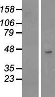 TSPAN17 Human Over-expression Lysates NM_130465