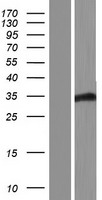 ls026263 fbxo22 human over expression lysates nm 012170 wb testing 2