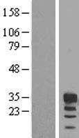 FBXO6 Human Over-expression Lysates NM_018438