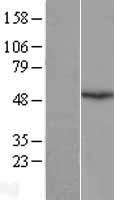 Emi1 (FBXO5) Human Over-expression Lysates NM_012177