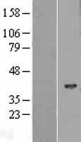 HIBCH Human Over-expression Lysates NM_014362