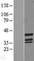 Tin2 (TINF2) Human Over-expression Lysates NM_012461