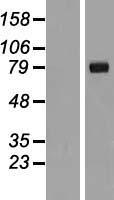 IL1RAPL2 Human Over-expression Lysates NM_017416