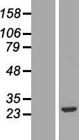 FGF20 Human Over-expression Lysates NM_019851