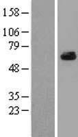 ARFGAP3 Human Over-expression Lysates NM_014570