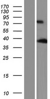 ANKRD2 Human Over-expression Lysates NM_001129981