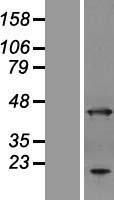 ANKRD2 Human Over-expression Lysates NM_020349