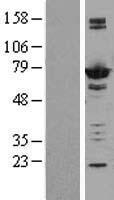 Adenylate kinase 5 (AK5) Human Over-expression Lysates NM_174858