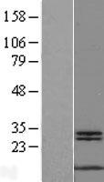 MYCBP Human Over-expression Lysates NM_012333