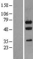 Nucleostemin (GNL3) Human Over-expression Lysates NM_014366