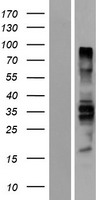 PTPN18 Human Over-expression Lysates NM_001142370
