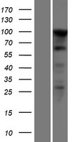 SEZ6L2 Human Over-expression Lysates NM_201575