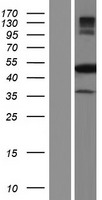 NARF Human Over-expression Lysates NM_001038618