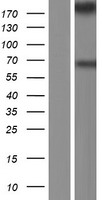 Myoferlin (MYOF) Human Over-expression Lysates NM_013451