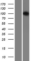 DDX26 (INTS6) Human Over-expression Lysates NM_012141
