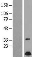 ls026515 fxc1 timm10b human over expression lysates nm 012192 wb testing 1