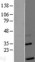TIMM13 Human Over-expression Lysates NM_012458