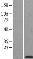 ls026519 timm10 human over expression lysates nm 012456 wb testing 1
