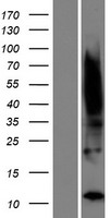 TIMM8B Human Over-expression Lysates NM_012459