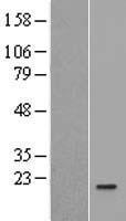 IL36RN Human Over-expression Lysates NM_012275