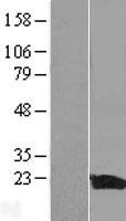 IL36RN Human Over-expression Lysates NM_173170
