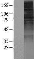 ls026538 or10h2 human over expression lysates nm 013939 wb testing 1