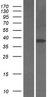 ITGB1BP2 Human Over-expression Lysates NM_012278