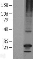 RGS17 Human Over-expression Lysates NM_012419