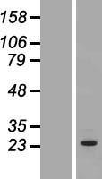 OSTF1 Human Over-expression Lysates NM_012383