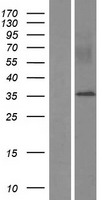 MYEOV Human Over-expression Lysates NM_138768