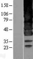 ls026580 bscl2 human over expression lysates nm 032667 wb testing 1