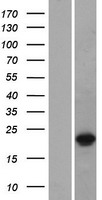 DUX3 Human Over-expression Lysates NM_012148