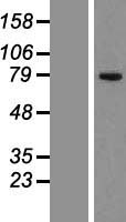 CKAP2 Human Over-expression Lysates NM_018204