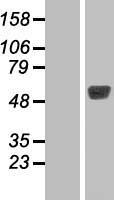 TBL2 Human Over-expression Lysates NM_012453