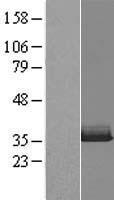 ls026609 vcx human over expression lysates nm 013452 wb testing 1