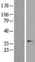OR7C1 Human Over-expression Lysates NM_198944